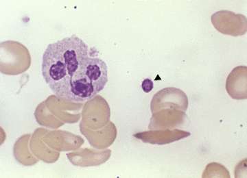 Mouse Myotubularin-related protein 14 (Mtmr14) -E. coli